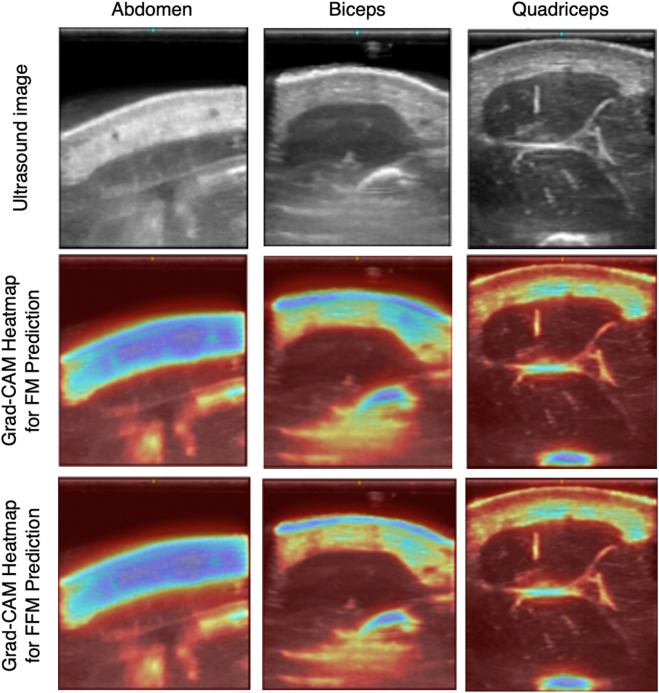 Grad-CAM visualizations showing the ultrasound image regions that most influenced the model's body-composition predictions.